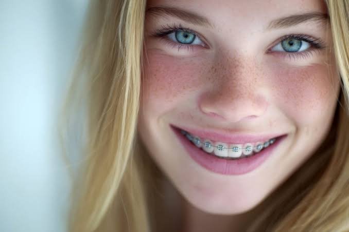 What Is The Proper Age For Orthodontic Care?
